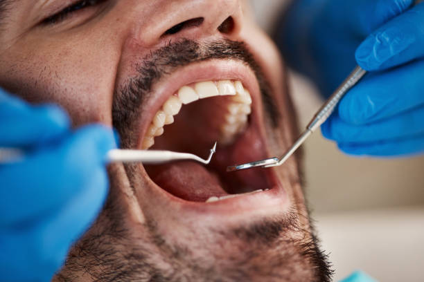 Best Wisdom Tooth Removal  in Stow, OH